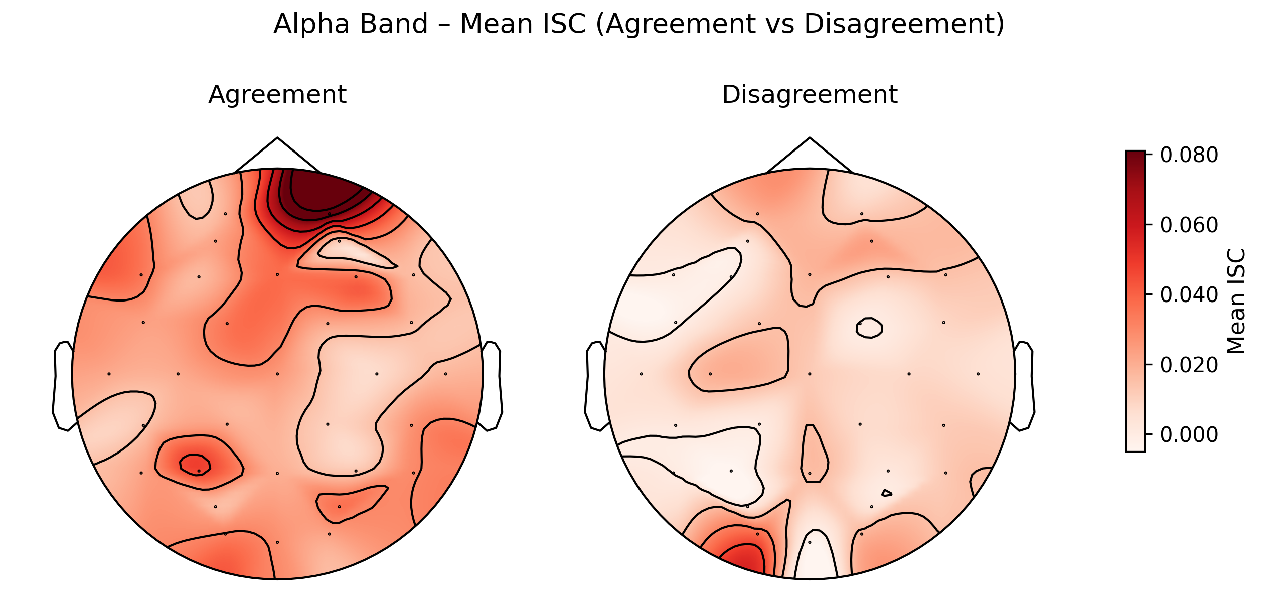 Alpha Band Topomaps - Agreement vs Disagreement Groups